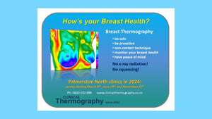 Have you ever had a Breast Thermography scan?